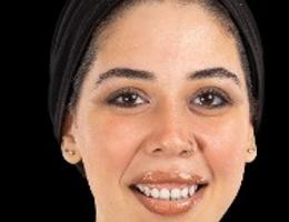 Israa  Mohamed 